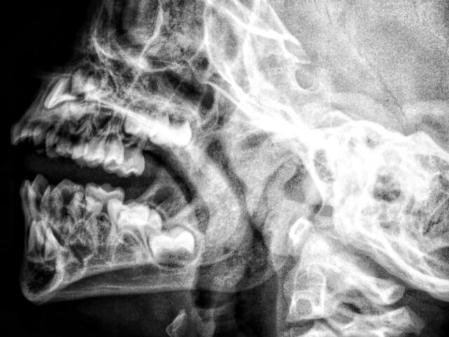 Radiologie dentaire