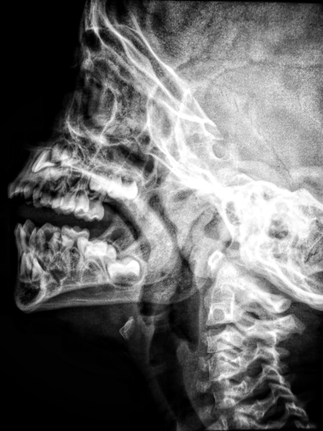 Radiologie dentaire